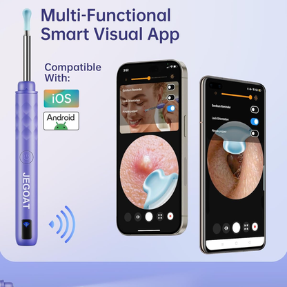 Ear Wax Remover with HD Camera