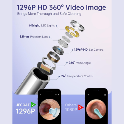 Ear Wax Remover with HD Camera